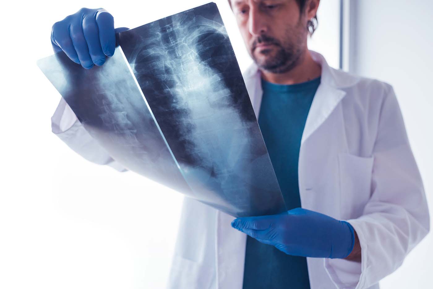 Doctor reviewing spine x-ray with patient for personal injury medical diagnosis.