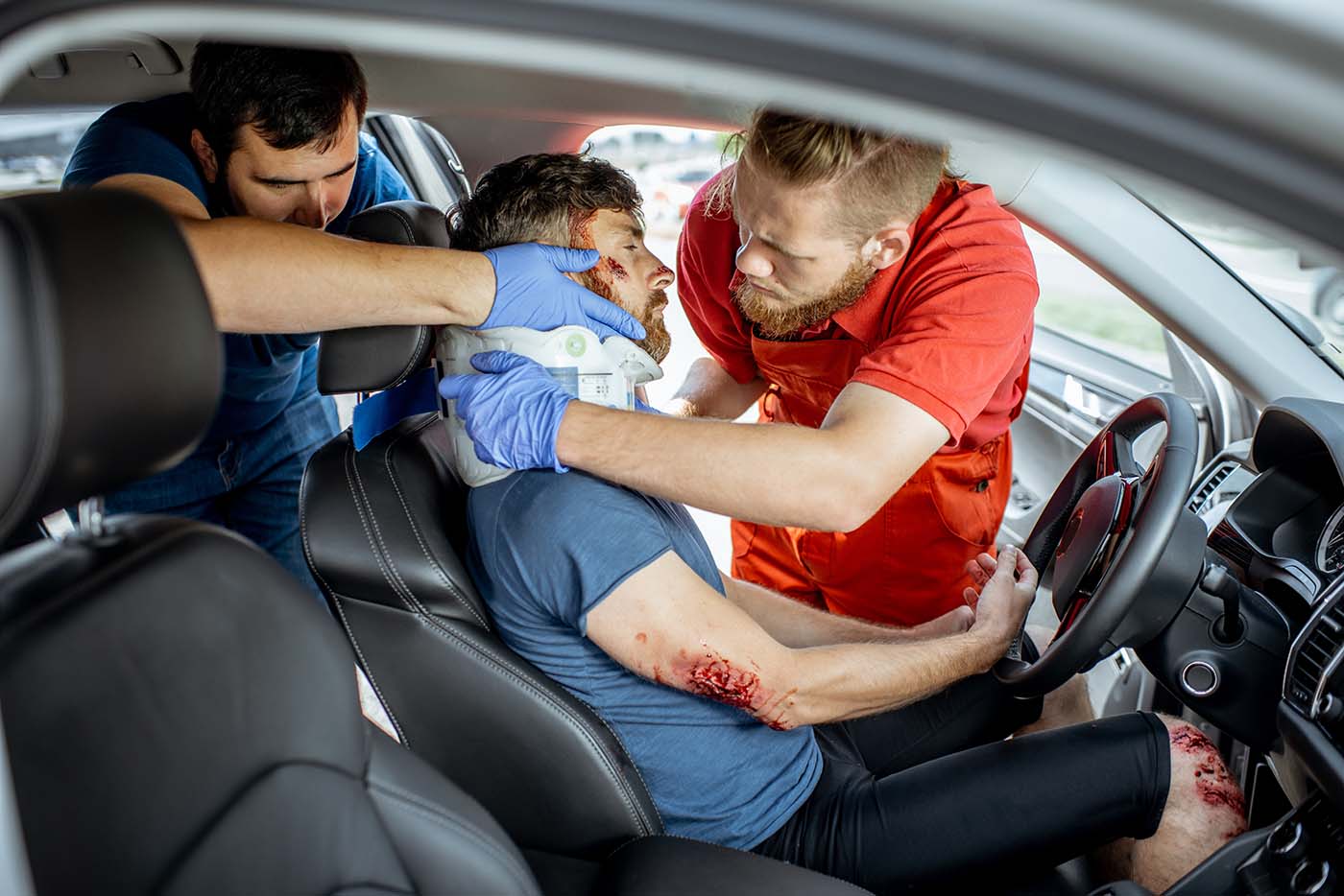 Anyone in California or the U.S. is eligible for transportation funding after a car accident or serious injuries